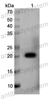 Anti-Human SMURF2 Polyclonal Antibody