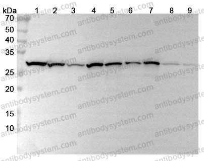 Anti-CACYBP Polyclonal Antibody