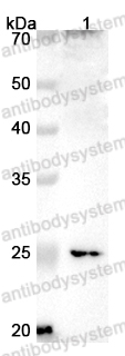 Anti-CLTRN Polyclonal Antibody