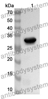 Anti-SGK2 Polyclonal Antibody