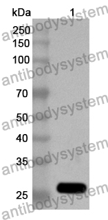 Anti-SPON1 Polyclonal Antibody