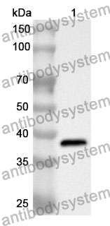 Anti-SYTL2 Polyclonal Antibody