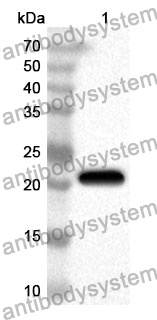 Anti-SDF2L1 Polyclonal Antibody