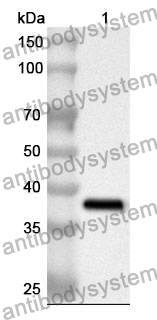 Anti-S100A14 Polyclonal Antibody