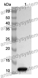 Anti-RETN Polyclonal Antibody