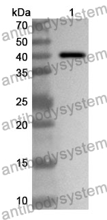 Anti-Human CD209 Polyclonal Antibody