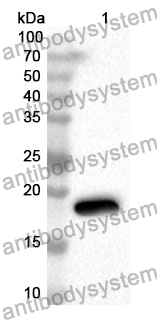 Anti-DNAJC4 Polyclonal Antibody