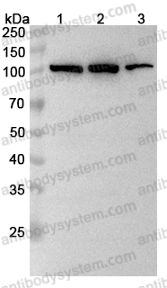 Anti-ABCB6 Polyclonal Antibody