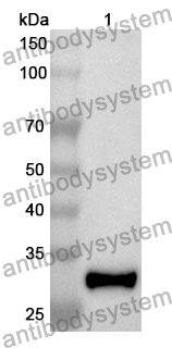 Anti-ABCB9 Polyclonal Antibody