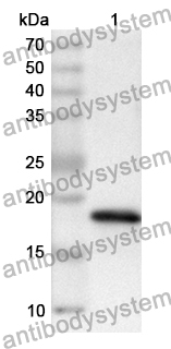 Anti-NPHS2 Polyclonal Antibody