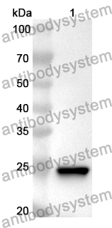 Anti-Human MMP25 Polyclonal Antibody