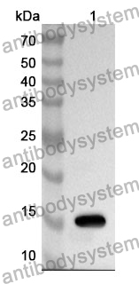 Anti-KCNK9 Polyclonal Antibody