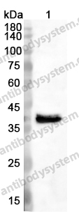 Anti-CD77/A4GALT Polyclonal Antibody