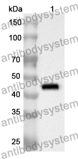 Anti-NGB Polyclonal Antibody