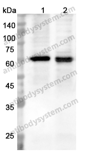 Anti-ACP6 Polyclonal Antibody