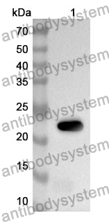 Anti-A1CF Polyclonal Antibody