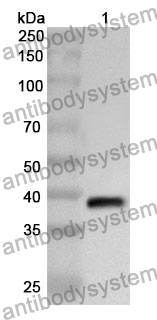 Anti-TRPV5 Polyclonal Antibody