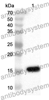 Anti-Human CD288/TLR8 Polyclonal Antibody