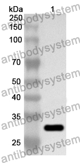 Anti-Human ABCB10 Polyclonal Antibody