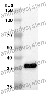 Anti-Human TREX1 Polyclonal Antibody