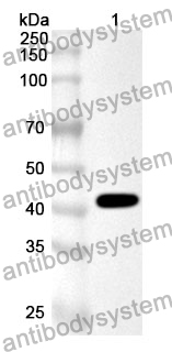 Anti-HIF1AN Polyclonal Antibody