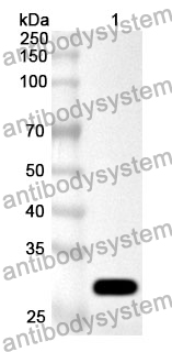 Anti-SPHK1 Polyclonal Antibody