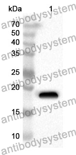 Anti-Human TREM2 Polyclonal Antibody