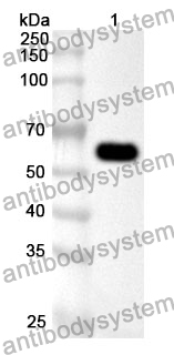 Anti-ADA2 Polyclonal Antibody