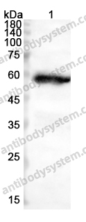 Anti-CD274/PD-L1/B7-H1 Polyclonal Antibody