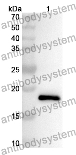 Anti-Human CALML5 Polyclonal Antibody