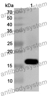 Anti-DSPP Polyclonal Antibody