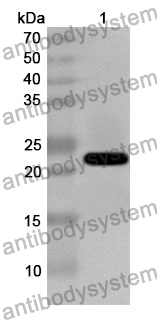 Anti-CLEC1B Polyclonal Antibody