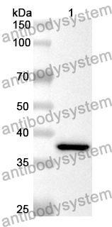 Anti-CD57/B3GAT1 Polyclonal Antibody