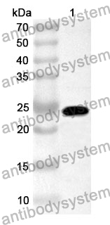 Anti-ATXN10 Polyclonal Antibody