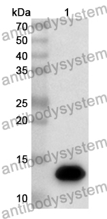 Anti-DNMT3B Polyclonal Antibody