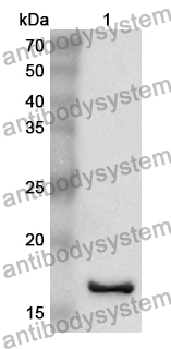 Anti-IL36RN Polyclonal Antibody