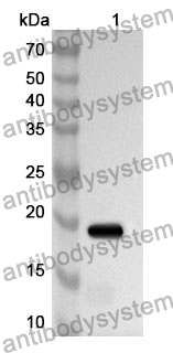 Anti-UXT Polyclonal Antibody