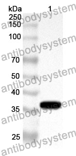 Anti-DKK3 Polyclonal Antibody