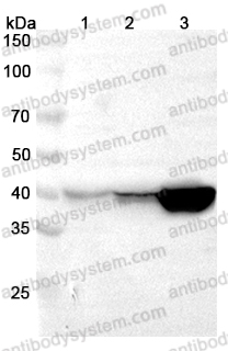 Anti-UPB1 Polyclonal Antibody