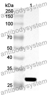 Anti-DKK2 Polyclonal Antibody