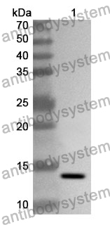 Anti-FBLN5 Polyclonal Antibody