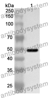 Anti-AASS Polyclonal Antibody