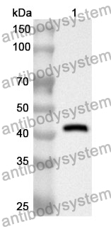 Anti-TJP2 Polyclonal Antibody