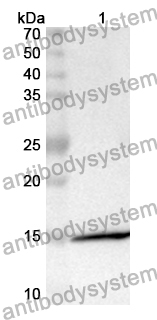 Anti-LAMTOR3 Polyclonal Antibody