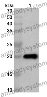 Anti-Human IL19 Polyclonal Antibody