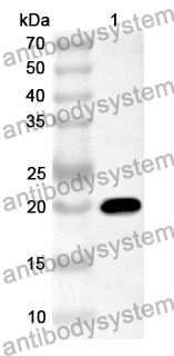 Anti-IL17B Polyclonal Antibody