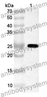 Anti-ADAMTS1 Polyclonal Antibody