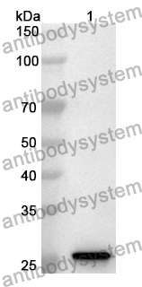 Anti-USP25 Polyclonal Antibody