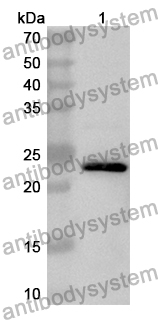 Anti-Human DACH1 Polyclonal Antibody