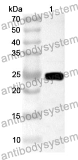 Anti-CD84 Polyclonal Antibody